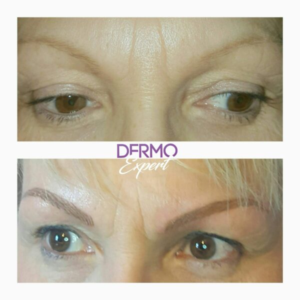 Dermo expert : maquillage permanent, traitement des cicatrices, extensions de cils
