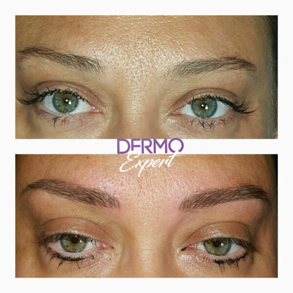Dermo expert : maquillage permanent, traitement des cicatrices, extensions de cils