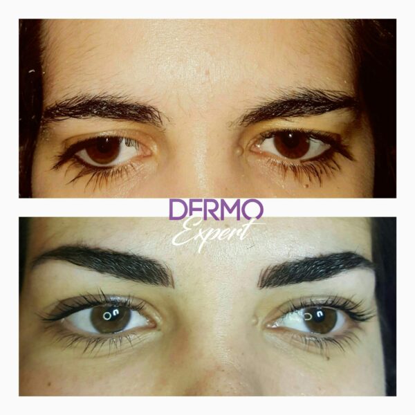 Dermo expert : maquillage permanent, traitement des cicatrices, extensions de cils