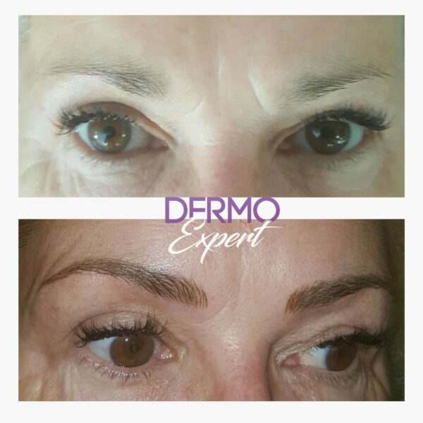 Dermo expert : maquillage permanent, traitement des cicatrices, extensions de cils