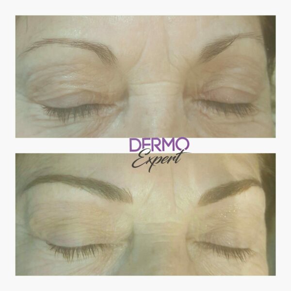Dermo expert : maquillage permanent, traitement des cicatrices, extensions de cils