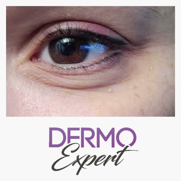 Dermo expert : maquillage permanent, traitement des cicatrices, extensions de cils