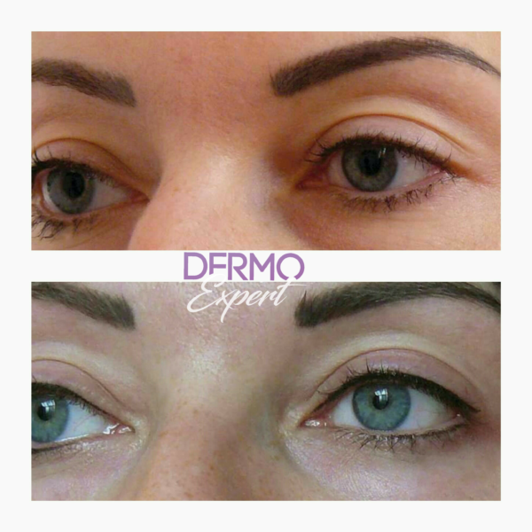 Dermo expert : maquillage permanent, traitement des cicatrices, extensions de cils