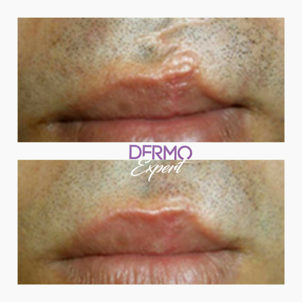 Dermo expert : maquillage permanent, traitement des cicatrices, extensions de cils