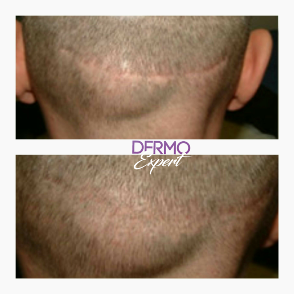 Dermo expert : maquillage permanent, traitement des cicatrices, extensions de cils