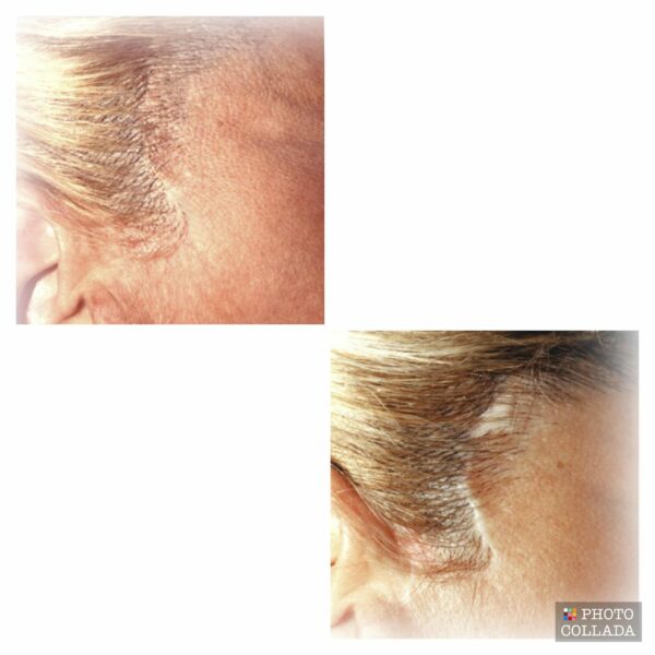 Dermo expert : maquillage permanent, traitement des cicatrices, extensions de cils