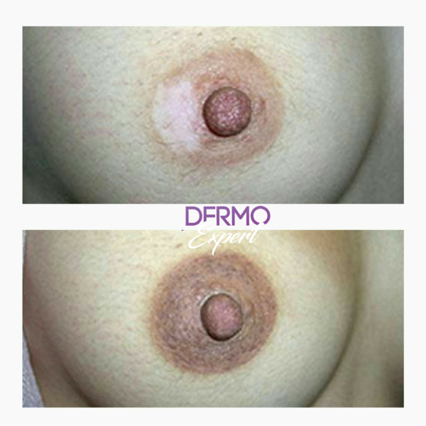 Dermo expert : maquillage permanent, traitement des cicatrices, extensions de cils