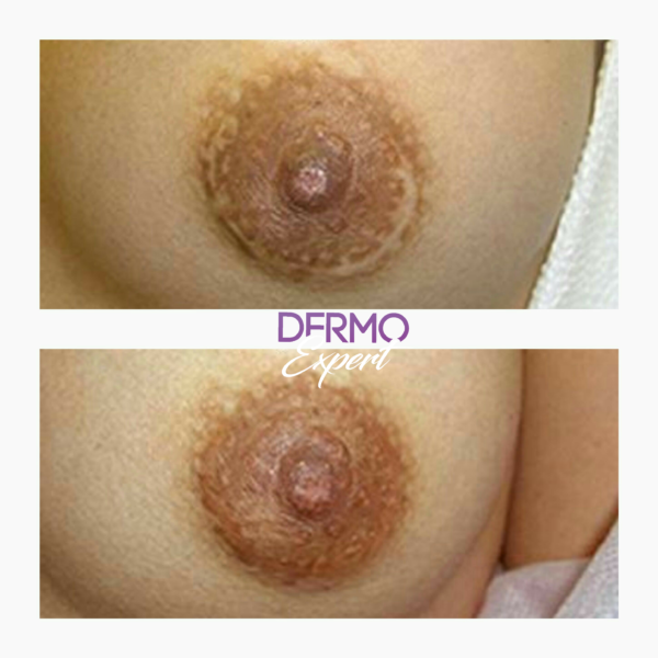 Dermo expert : maquillage permanent, traitement des cicatrices, extensions de cils