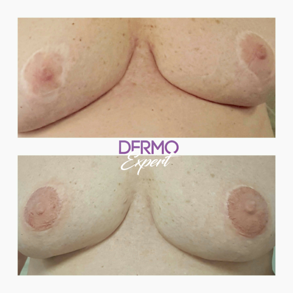 Dermo expert : maquillage permanent, traitement des cicatrices, extensions de cils