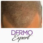 Dermo expert : maquillage permanent, traitement des cicatrices, extensions de cils