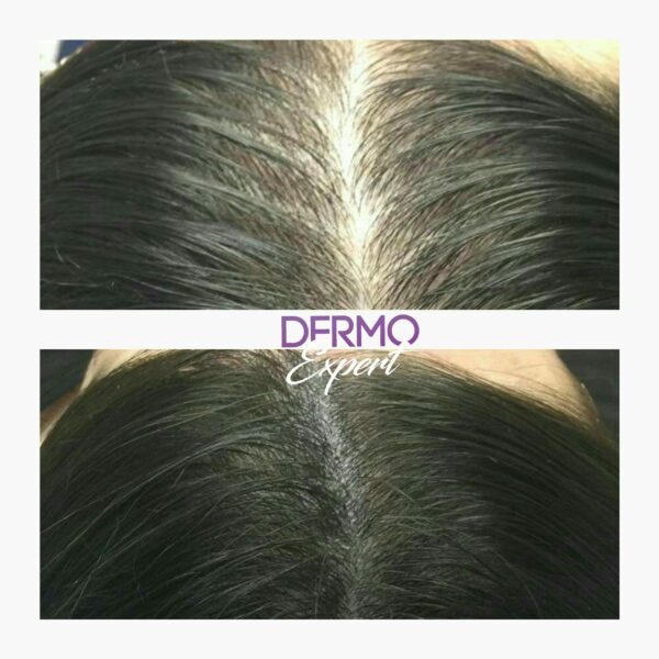 Dermo expert : maquillage permanent, traitement des cicatrices, extensions de cils