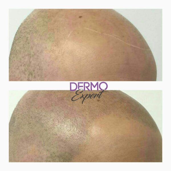 Dermo expert : maquillage permanent, traitement des cicatrices, extensions de cils