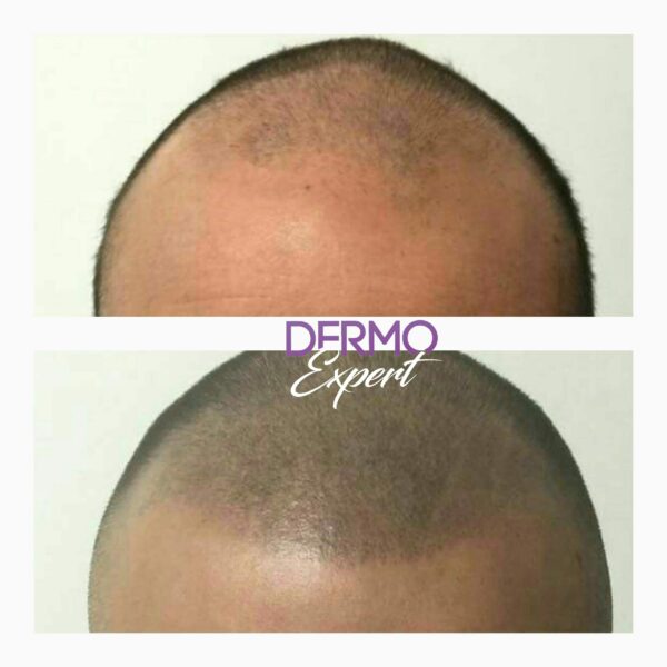 Dermo expert : maquillage permanent, traitement des cicatrices, extensions de cils