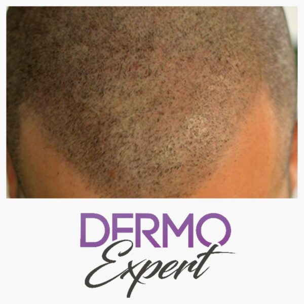 Dermo expert : maquillage permanent, traitement des cicatrices, extensions de cils