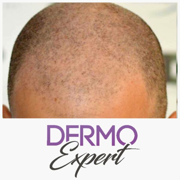 Dermo expert : maquillage permanent, traitement des cicatrices, extensions de cils