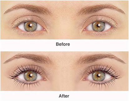 Dermo expert : maquillage permanent, traitement des cicatrices, extensions de cils